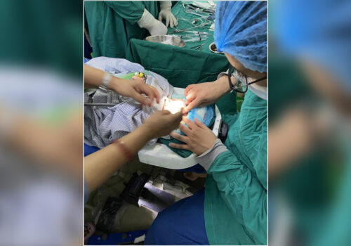 आँखा उपचारमा ऐतिहासिक फड्को : २९ हप्तामा जन्मेको शिशुको ‘लेन्स स्पेयरिङ भिट्रेक्टोमी’ सफल